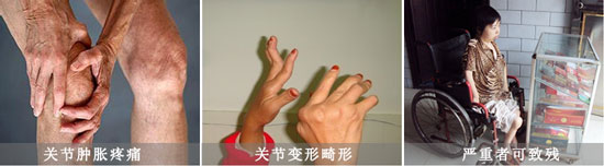 Fꖏ(qing)ֱt(y)ԺL(fng)(hu)(do)P(gun)(ji)[ʹ.jpg
