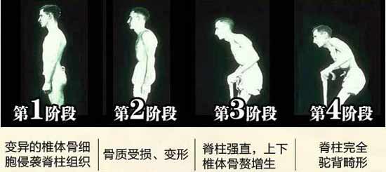 Fꖏ(qing)ֱt(y)Ժ(qing)ֱԼ׳ʹYҕ(hu)P(gun)(ji)׃Σ.jpg