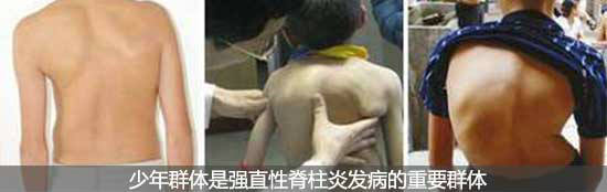 F(yng)(qing)ֱt(y)Ժꃺͯɞ鏊(qing)ֱl(f)ҪĿ(bio).jpg